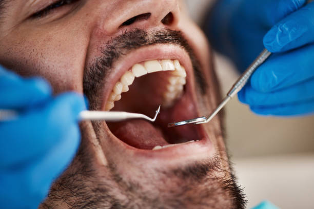 Best Emergency Tooth Extraction in Watervliet, MI