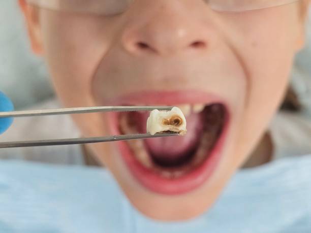 Best Weekend Emergency Dentist in Watervliet, MI